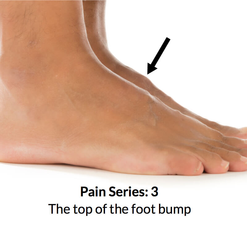 Foot bump on top of the foot 