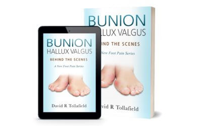 Bunion Behind the Scenes
