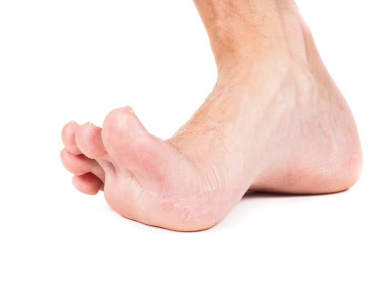 Locating foot pain | Consulting Footpain