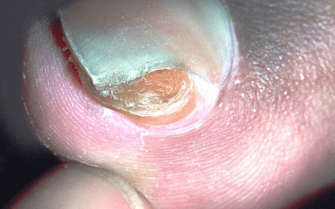 What’s this at the end of my toe?