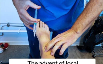 When did podiatrists first use local anaesthetic?