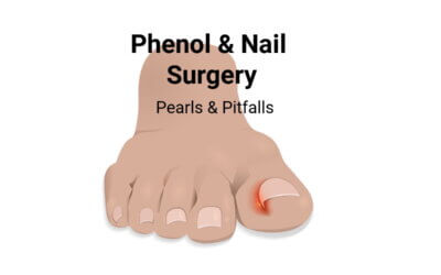 Phenolic Nail Surgery