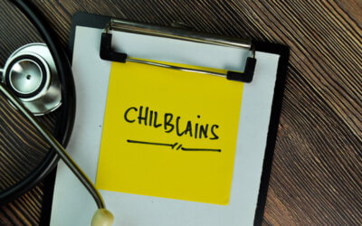 Chilblains and presenting features