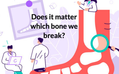 Does it matter which foot bone you break?