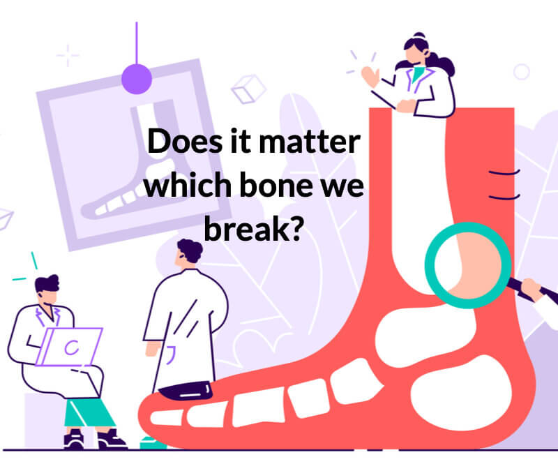 Does it matter which foot bone you break?