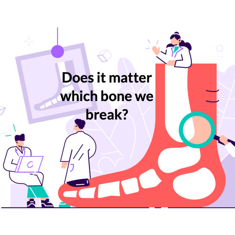 does-it-matter-which-foot-bone-you-break-consulting-footpain