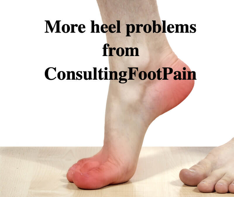 More about heel problems