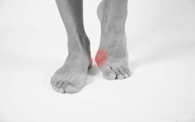 Arthritis and the big toe