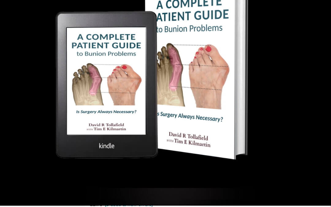 New Bunion Guide for Patients 2025