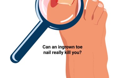 Can an Ingrown Nail Kill?